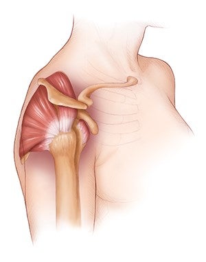 Rotator cuff None