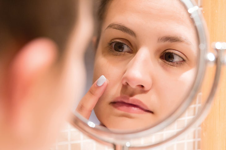 Skinare 2 Woman treating pimple in the mirror